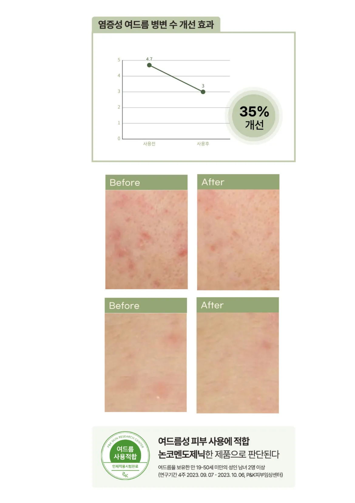 Shampoo Bar   Facial Cleansing Bar 공구구성